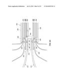 MEDICAL DEVICE FOR MODIFICATION OF LEFT ATRIAL APPENDAGE AND RELATED     SYSTEMS AND METHODS diagram and image