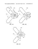 MEDICAL DEVICE FOR MODIFICATION OF LEFT ATRIAL APPENDAGE AND RELATED     SYSTEMS AND METHODS diagram and image