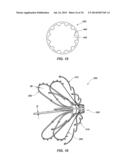 MEDICAL DEVICE FOR MODIFICATION OF LEFT ATRIAL APPENDAGE AND RELATED     SYSTEMS AND METHODS diagram and image