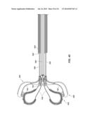 MEDICAL DEVICE FOR MODIFICATION OF LEFT ATRIAL APPENDAGE AND RELATED     SYSTEMS AND METHODS diagram and image