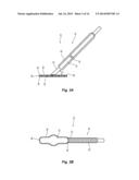 Vessel Sealing Device with Automatic Deployment diagram and image