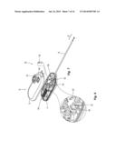 Vessel Sealing Device with Automatic Deployment diagram and image