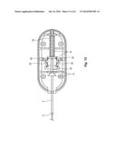 Vessel Sealing Device with Automatic Deployment diagram and image