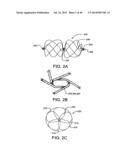 Sealing Device and Delivery System diagram and image