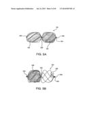 Sealing Device and Delivery System diagram and image