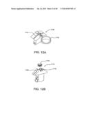 Sealing Device and Delivery System diagram and image