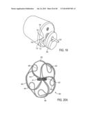 Sealing Device and Delivery System diagram and image