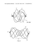 Sealing Device and Delivery System diagram and image