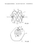 Sealing Device and Delivery System diagram and image