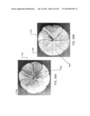 Sealing Device and Delivery System diagram and image