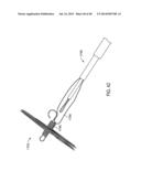 Sealing Device and Delivery System diagram and image