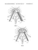 SURGICAL SYSTEM AND METHODS OF USE diagram and image