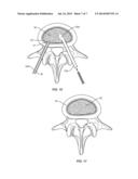 SURGICAL SYSTEM AND METHODS OF USE diagram and image