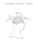 METHODS AND APPARATUS FOR TRANSCRANIAL STIMULATION diagram and image