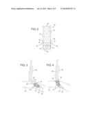 STENT WITH POSITIONING ARMS diagram and image