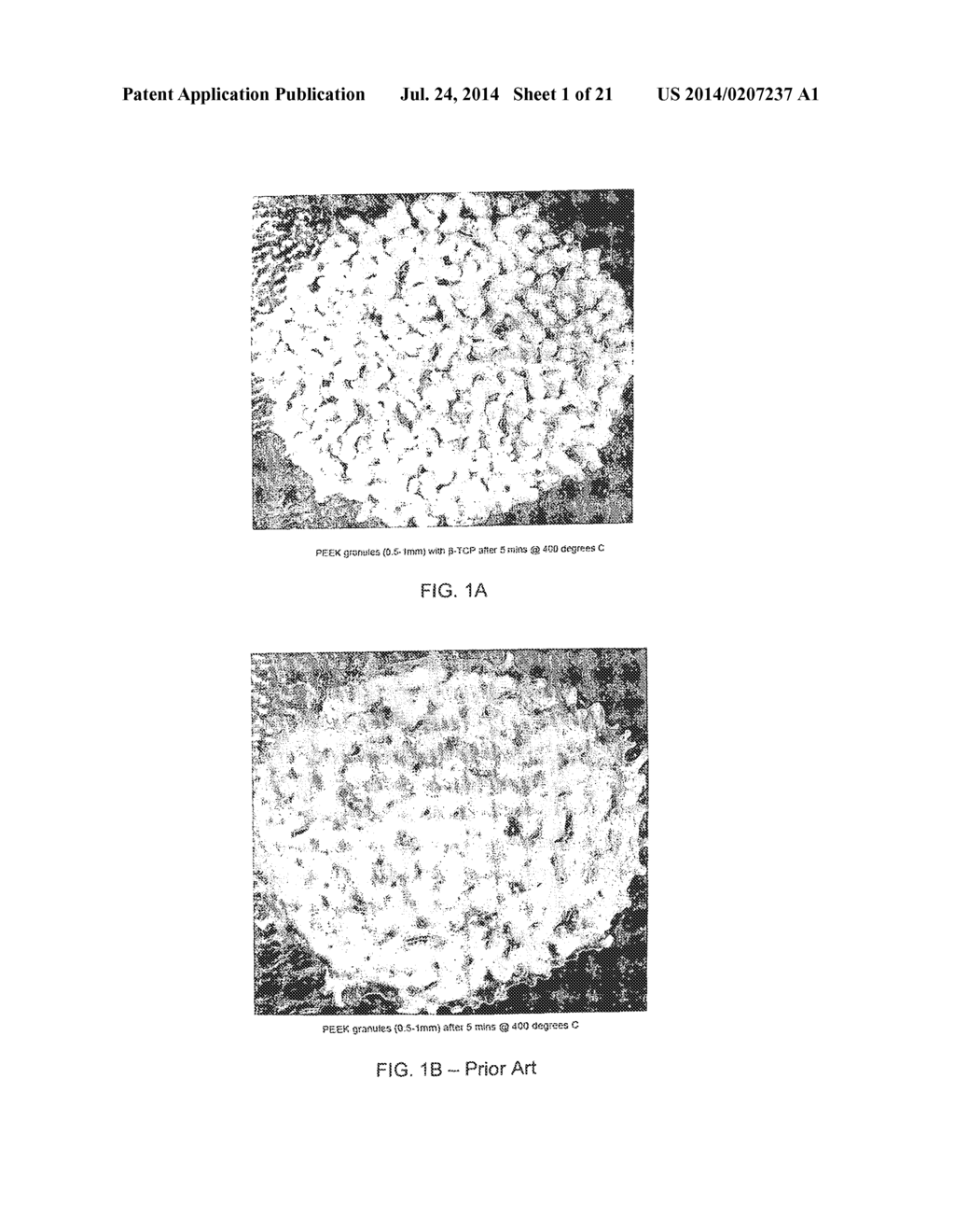 Porous Biocompatible Polymer Material and Methods - diagram, schematic, and image 02