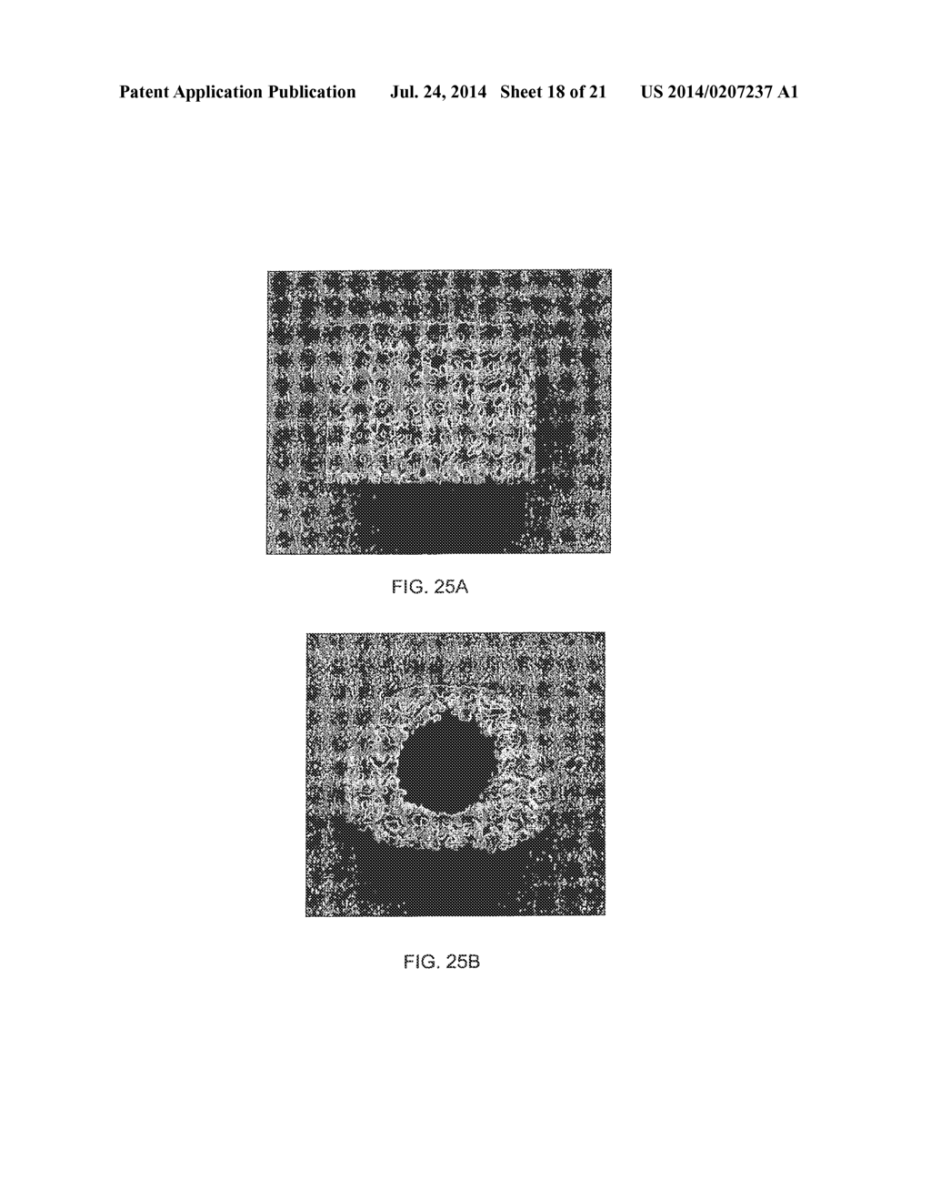 Porous Biocompatible Polymer Material and Methods - diagram, schematic, and image 19