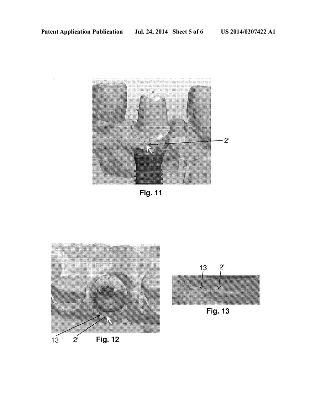 TOOLS FOR CUSTOMIZED DESIGN OF DENTAL RESTORATIONS - diagram, schematic, and image 06
