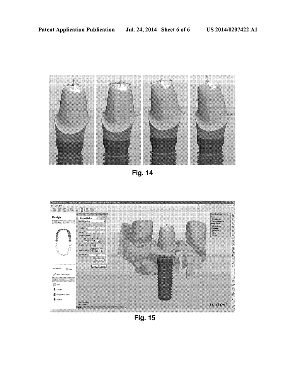 TOOLS FOR CUSTOMIZED DESIGN OF DENTAL RESTORATIONS - diagram, schematic, and image 07