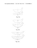 SLAG LADLE FOR SEPARATION AND RECOVERY OF MOLTEN IRON FROM SLAG diagram and image