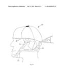 DEVICE FOR THE HINDRANCE OF SNORING AND OBSTRUCTIVE SLEEP APNEA diagram and image