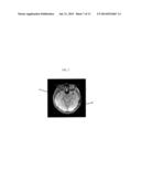 MAGNETIC RESONANCE IMAGING APPARATUS AND SUSCEPTIBILITY-WEIGHTED IMAGING     METHOD USING THE SAME diagram and image