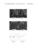 FAST RENDERING OF CURVED REFORMATION OF A 3D TUBULAR STRUCTURE diagram and image