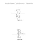 ADJUSTABLE REFRACTIVE OPTICAL DEVICE diagram and image