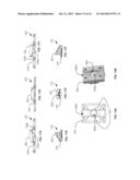 AUDIO LISTENING SYSTEM diagram and image