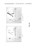 Component Based Correspondence Matching for Reconstructing Cables diagram and image