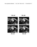 De-noising of Real-time Dynamic Magnetic Resonance Images by the Combined     Application of Karhunen-Loeve Transform (KLT) and Wavelet Filtering diagram and image