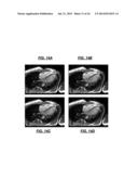 De-noising of Real-time Dynamic Magnetic Resonance Images by the Combined     Application of Karhunen-Loeve Transform (KLT) and Wavelet Filtering diagram and image