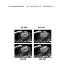 De-noising of Real-time Dynamic Magnetic Resonance Images by the Combined     Application of Karhunen-Loeve Transform (KLT) and Wavelet Filtering diagram and image