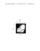 X-RAY CT APPARATUS AND IMAGE CORRECTION METHOD diagram and image