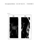 SCREENING METHOD FOR THERAPEUTIC AGENT FOR CHONDROPATHY AND MODIFIED     CHONDROCYTE FOR TREATMENT OF CHONDROPATHY diagram and image