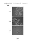 Cancer Analysis System diagram and image