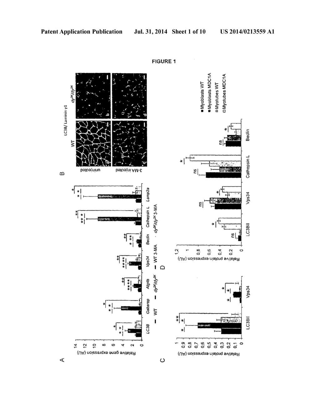 COMPOSITIONS AND TREATMENTS FOR DYSTROPHIES - diagram, schematic, and image 02