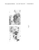 MEDICAMENT FOR TREATING PERIPHERAL NEUROPATHIES diagram and image