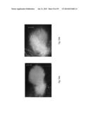 MEDICAMENT FOR TREATING PERIPHERAL NEUROPATHIES diagram and image