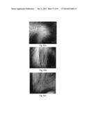 MEDICAMENT FOR TREATING PERIPHERAL NEUROPATHIES diagram and image