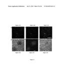 Imaging Beta-Amyloid Peptides and Inhibition of Beta-Amyloid Peptide     Aggregation diagram and image