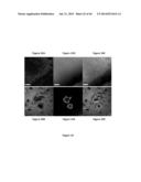 Imaging Beta-Amyloid Peptides and Inhibition of Beta-Amyloid Peptide     Aggregation diagram and image