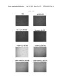 FUSION PROTEIN FOR SUPPRESSING CANCER CELL GROWTH AND SUPPRESSING     VASCULOGENESIS, AND ANTICANCER COMPOSITION COMPRISING SAME diagram and image