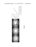 CEST MRI METHODS FOR IMAGING GLUTAMINOLYSIS IN CANCER diagram and image