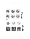 CEST MRI METHODS FOR IMAGING GLUTAMINOLYSIS IN CANCER diagram and image