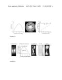 CEST MRI METHODS FOR IMAGING GLUTAMINOLYSIS IN CANCER diagram and image