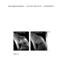 CEST MRI METHODS FOR IMAGING GLUTAMINOLYSIS IN CANCER diagram and image