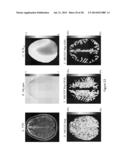 CEST MRI METHODS FOR IMAGING GLUTAMINOLYSIS IN CANCER diagram and image