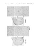 CEST MRI METHODS FOR IMAGING GLUTAMINOLYSIS IN CANCER diagram and image