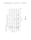 SYSTEM AND METHOD FOR RECONSTRUCTING CARDIAC SIGNALS ASSOCIATED WITH A     COMPLEX RHYTHM DISORDER diagram and image